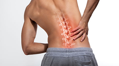 patient requiring vertebral subluxation treatment in Sacramento